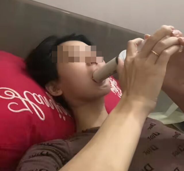 Hình ảnh cô gái mắc ung thư xương hàm, bữa ăn hàng ngày là "cháo xay loãng ăn bằng xi lanh" gây xót xa: Dấu hiệu phát hiện bệnh sớm trước khi quá muộn hinh anh co gai mac ung thu xuong ham bua an hang ngay la chao xay loang an bang xi lanh gay xot xa dau hieu phat hien benh som truoc khi qua muon