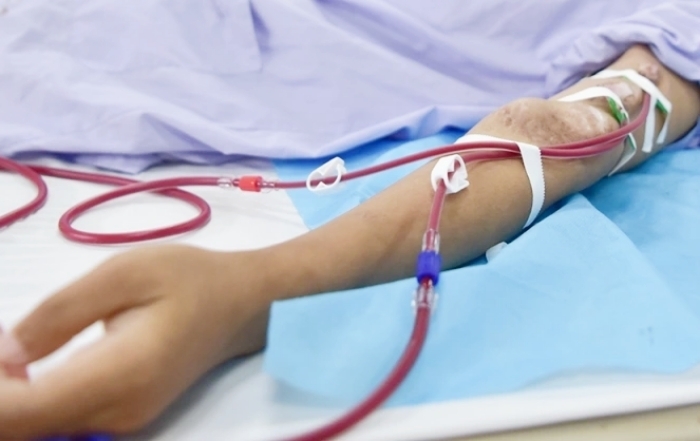 Suy thận ở tuổi 32 sau nhiều năm lạm dụng sản phẩm tăng cơ suy than o tuoi 32 sau nhieu nam lam dung san pham tang co