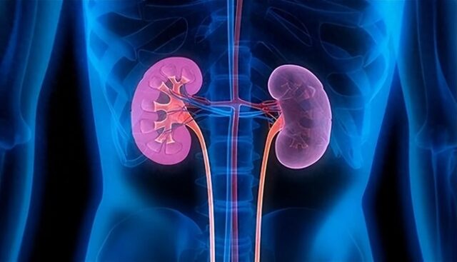 Ngày càng nhiều người mắc ung thư thận, chỉ 30% được chẩn đoán sớm: Đừng bỏ qua 5 triệu chứng này 1 Ngày càng nhiều người mắc ung thư thận, chỉ 30% được chẩn đoán sớm: Đừng bỏ qua 5 triệu chứng này